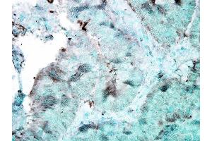 Immunohistochemistry analysis using Mouse Anti-Hsp90 Monoclonal Antibody, Clone 4F3. (HSP90 anticorps)