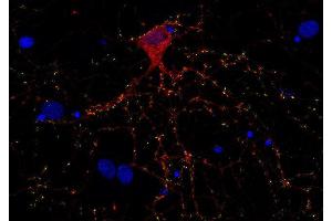 Indirect immunostaining of PFA fixed rat hippocampus neurons with anti-Complexin 1/2 (dilution 1 : 500; red) and mouse anti-synapsin 1 (cat. (Complexin 1, 2 (AA 122-134) anticorps)