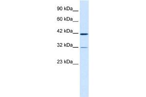 WB Suggested Anti-CHST4 Antibody Titration:  0. (CHST4 anticorps  (Middle Region))