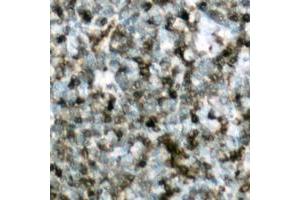 Immunohistochemical analysis of c-CBL (pY700) staining in human lymph node formalin fixed paraffin embedded tissue section.