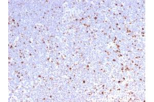 Formalin-fixed, paraffin-embedded human Lymph Node stained with MCM7 Rabbit Recombinant Monoclonal Antibody (MCM7/2832R). (Recombinant MCM7 anticorps  (AA 195-319))