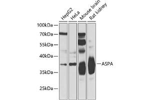 Western blot analysis of extracts of various cell lines, using ASPA Antibody (ABIN6127373, ABIN6137211, ABIN6137212 and ABIN6223094) at 1:500 dilution. (ASPA anticorps  (AA 1-313))
