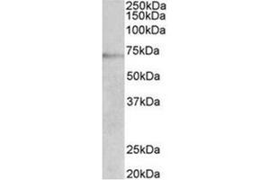 AP31950PU-N DBH antibody staining of Jurkat lysate at 2 µg/ml (35µg protein in RIPA buffer). (DBH anticorps  (Internal Region))