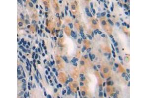 Used in DAB staining on fromalin fixed paraffin-embedded stomach tissue (MYLK3 anticorps  (AA 555-786))