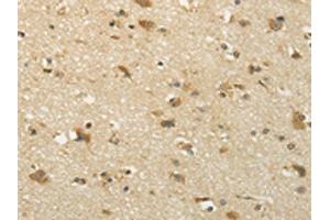 The image on the left is immunohistochemistry of paraffin-embedded Human brain tissue using ABIN7131002(SEMA4F Antibody) at dilution 1/35, on the right is treated with fusion protein. (SEMA4F anticorps)