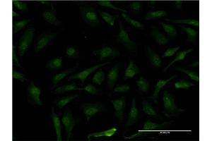 Immunofluorescence of monoclonal antibody to MAGEB1 on HeLa cell.