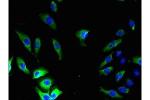 Immunofluorescent analysis of A549 cells using ABIN7153621 at dilution of 1:100 and Alexa Fluor 488-congugated AffiniPure Goat Anti-Rabbit IgG(H+L)