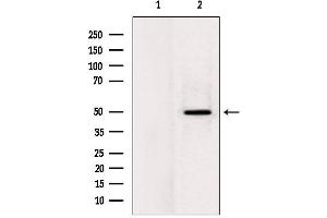 Western blot analysis of extracts from rat heart, using LPCAT2 Antibody.