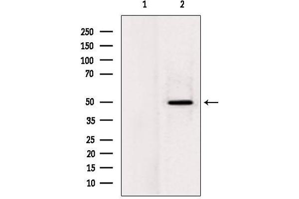 LPCAT2 antibody  (N-Term)