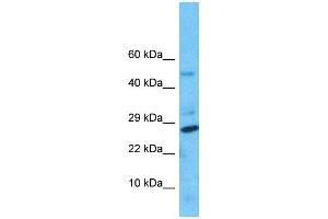Western Blotting (WB) image for anti-Nudix Hydrolase 8 (NUDT8) (N-Term) antibody (ABIN2791709) (NUDT8 anticorps  (N-Term))