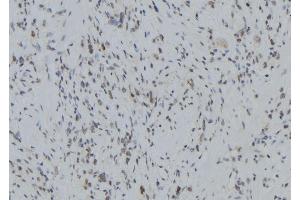 ABIN6279400 at 1/100 staining Human gastric tissue by IHC-P. (RNF123 anticorps  (N-Term))