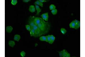 Immunofluorescence staining of MCF-7 cells with ABIN7149870 at 1:133, counter-stained with DAPI. (SAT2 anticorps  (AA 1-170))