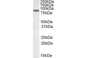 Western Blotting (WB) image for anti-Tripartite Motif Containing 3 (TRIM3) (N-Term) antibody (ABIN2465468) (TRIM3 anticorps  (N-Term))