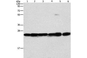 Western Blot analysis of Mouse liver and brain tissue, 293T, A549, A431 and PC3 cell using SIGMAR1 Polyclonal Antibody at dilution of 1:310 (SIGMAR1 anticorps)