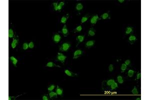 Immunofluorescence of monoclonal antibody to MEOX2 on HeLa cell. (MEOX2 anticorps  (AA 1-303))