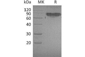 Western Blotting (WB) image for Intercellular Adhesion Molecule 2 (ICAM2) protein (Fc Tag) (ABIN7320710)