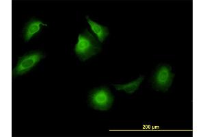 Immunofluorescence of monoclonal antibody to CCT5 on HeLa cell.