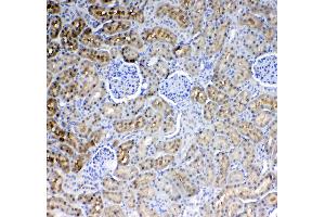 IHC analysis of Glycerol kinase using anti-Glycerol kinase antibody .