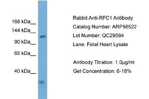 WB Suggested Anti-RFC1  Antibody Titration: 0. (RFC1 anticorps  (Middle Region))