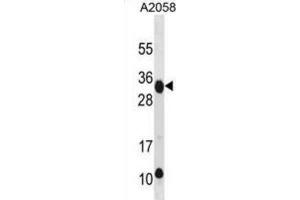 Western Blotting (WB) image for anti-Retinoic Acid Early Transcript 1E (RAET1E) antibody (ABIN3001003) (Retinoic Acid Early Transcript 1E (RAET1E) anticorps)