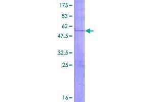 SDS-PAGE (SDS) image for E3 Ubiquitin-Protein Ligase UNKL (UNKL) (AA 1-229) protein (GST tag) (ABIN1324673)