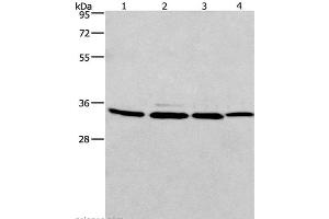 Western Blot analysis of A549, 231, PC3 and hela cell using MAD2L1BP Polyclonal Antibody at dilution of 1:675 (MAD2L1BP anticorps)