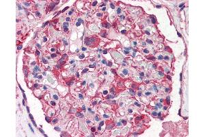 Anti-Nestin antibody IHC of human kidney. (Nestin anticorps  (AA 1464-1614))