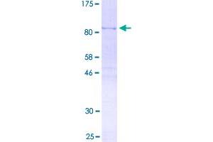 Image no. 1 for Heterogeneous Nuclear Ribonucleoprotein L (HNRNPL) (AA 1-558) protein (GST tag) (ABIN2566104)