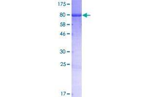 Image no. 1 for Cancer Susceptibility Candidate 4 (CASC4) (AA 1-436) protein (GST tag) (ABIN1348083)