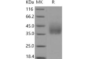 Western Blotting (WB) image for Growth Hormone Receptor (GHR) (Active) protein (His tag) (ABIN7321234)