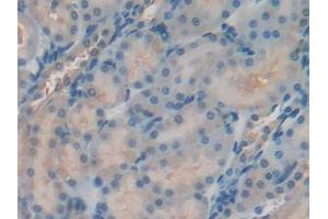 DAB staining on IHC-P; Samples: Rat Kidney Tissue