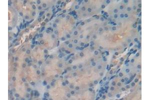 DAB staining on IHC-P; Samples: Rat Kidney Tissue (TIMP2 anticorps  (AA 27-220))