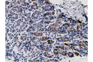 Immunohistochemical staining of paraffin-embedded Human breast tissue using anti-CRYM mouse monoclonal antibody. (CRYM anticorps)