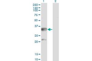 Western Blot analysis of CBR3 expression in transfected 293T cell line by CBR3 monoclonal antibody (M05), clone 1G8.