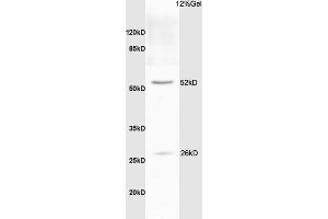 Rat brain lysate probed with Anti Bcl-xL/BCL2L1/bcl-xs Polyclonal Antibody, Unconjugated (ABIN675129) at 1:200 overnight at 4 °C.