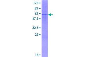 Image no. 1 for Hydroxysteroid (17-Beta) Dehydrogenase 7 (HSD17B7) (AA 1-341) protein (GST tag) (ABIN1307134)