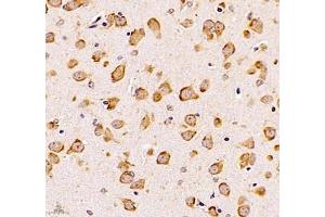 Immunohistochemistry of paraffin embedded mouse brain using UQCC (ABIN7076094) at dilution of 1: 1000 (400x lens) (Ubiquinol-Cytochrome C Reductase Complex Chaperone (UQCC) anticorps)