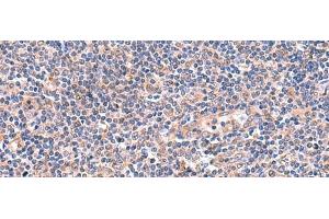 Immunohistochemistry of paraffin-embedded Human tonsil tissue using OSBPL2 Polyclonal Antibody at dilution of 1:55(x200) (OSBPL2 anticorps)