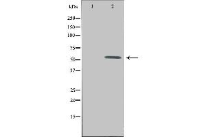 Western blot analysis of extracts from HepG2 cells, using UEVLD antibody. (UEVLD anticorps  (N-Term))