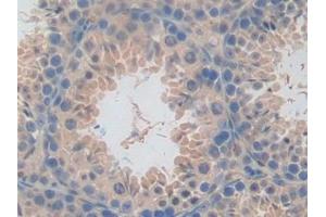 Detection of CD301 in Mouse Testis Tissue using Polyclonal Antibody to Cluster Of differentiation 301 (CD301)