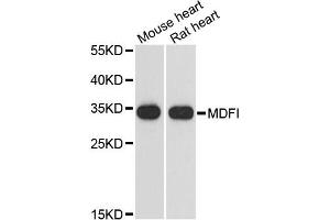 Western blot analysis of extracts of various cell lines, using MDFI antibody. (MDFI anticorps)