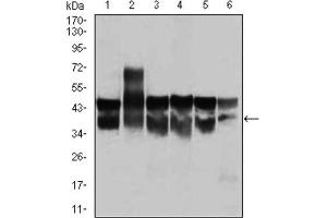 Western blot analysis using CDK2 antibody against Jurkat (1), HL-60 (2), K562 (3), A431 (4), HeLa (5), and NIH3T3 (6) cell lysate.