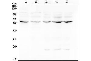 Western blot analysis of Lumican using anti-Lumican antibody (ABIN6719339).