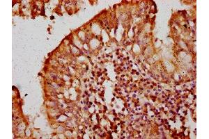 IHC image of ABIN7175220 diluted at 1:300 and staining in paraffin-embedded human lung tissue performed on a Leica BondTM system.