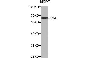 Western blot analysis of extracts of MCF-7 cell line, using PKR antibody. (EIF2AK2 anticorps)