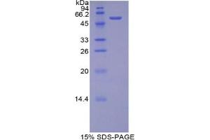 SDS-PAGE analysis of Rat bACE2 Protein.