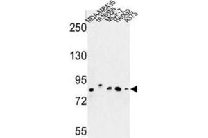 Western Blotting (WB) image for anti-Chondroitin Polymerizing Factor (CHPF) antibody (ABIN3004012) (CHPF anticorps)