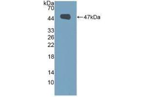 Detection of Recombinant MUC1, Human using Polyclonal Antibody to Mucin 1 (MUC1) (MUC1 anticorps  (AA 1098-1255))