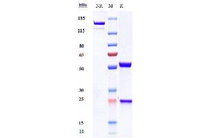 Anti-TREM1 / CD354 Reference Antibody (PY159) on SDS-PAGE under reducing (R) condition.