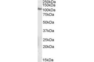 Western Blotting (WB) image for anti-Integrin beta 5 (ITGB5) (C-Term) antibody (ABIN2465852) (Integrin beta 5 anticorps  (C-Term))